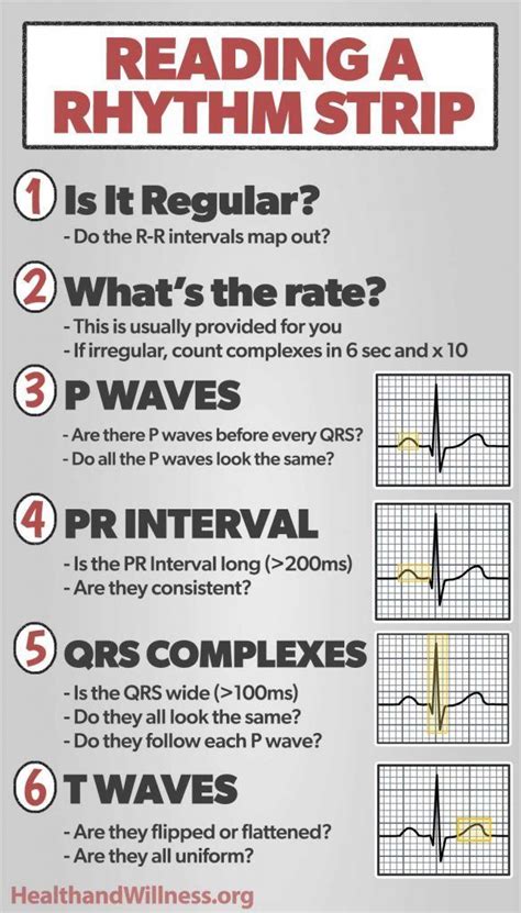 how to read ekg test results|How to Read an EKG Strip in 5 Steps .